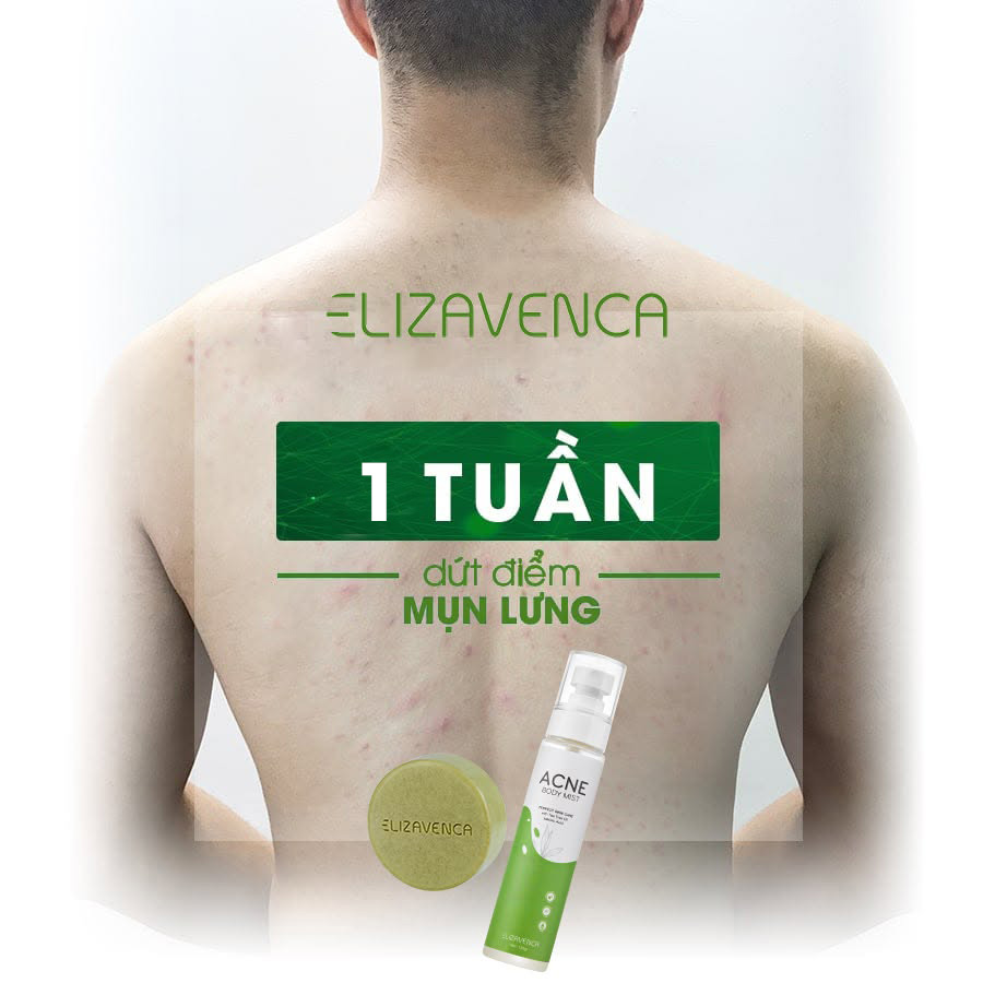 Cách trị mụn lưng trong 1 tuần